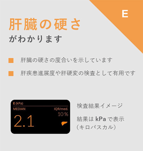 エコーのイメージ写真