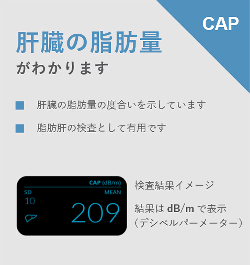 エコーのイメージ写真